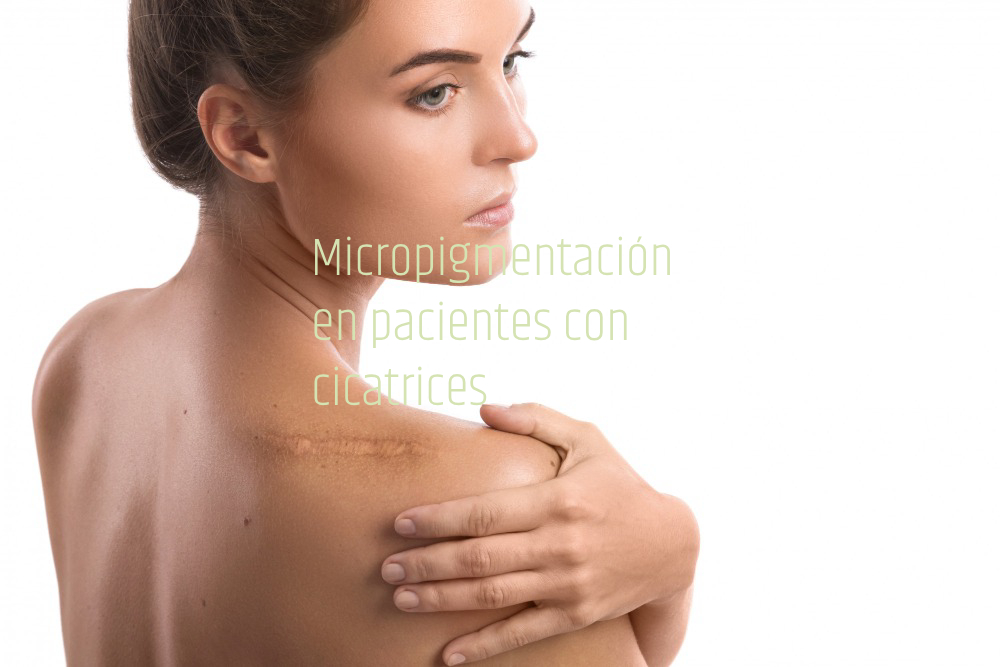 Micropigmentación en pacientes con cicatrices